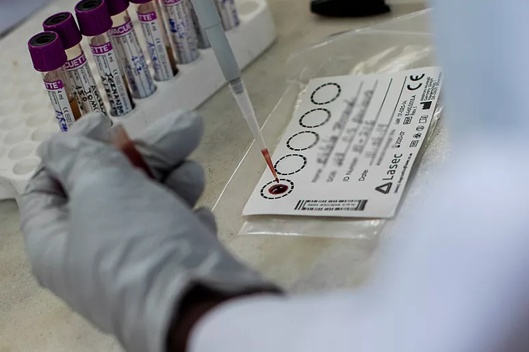 Un técnico de laboratorio de MSF analiza la carga viral de VIH de un paciente en Mozambique.