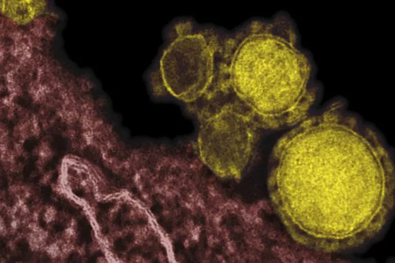 Imagen en las que se aprecian partículas del nuevo coronavirus.