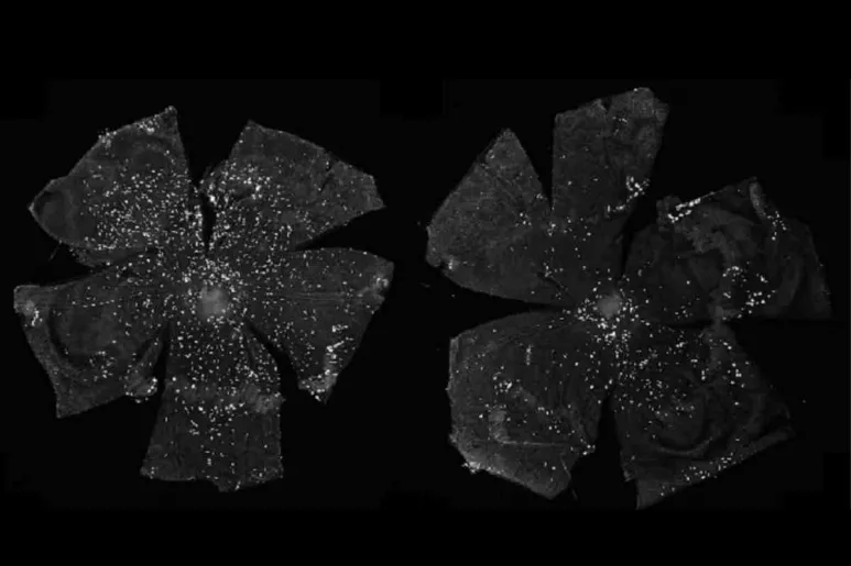 Imágenes de las coroides de ratones control (izquierda) y tras la eliminación de IHH de  las células endoteliales (derecha), lo que resulta en una disminución del número de mastocitos (puntos blancos).