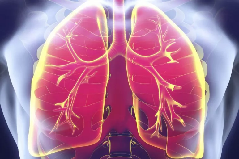 La enfermedad pulmonar intersticial representa casi el 35% de la mortalidad relacionada con la esclerosis sistémica.