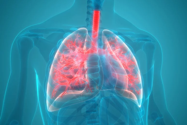 El cáncer de pulmón es la principal causa de muerte por cáncer en todo el mundo