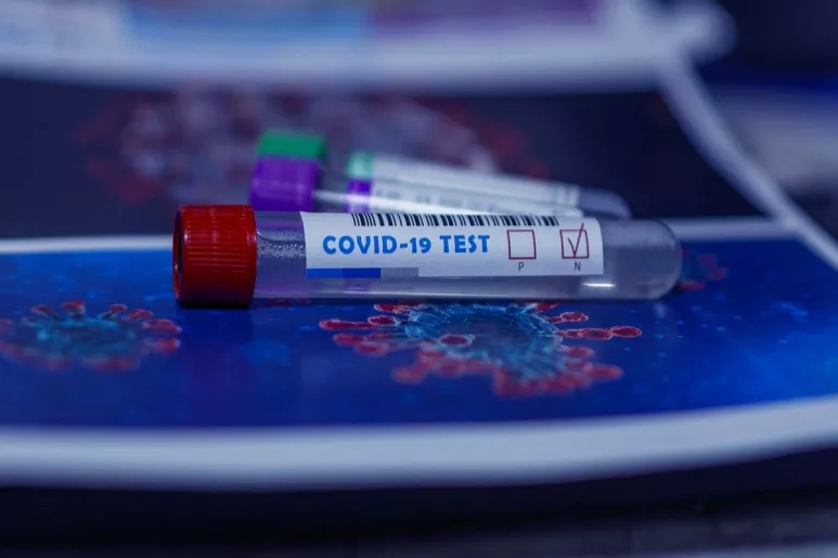 Un tubo con una muestra para un test del coronavirus.