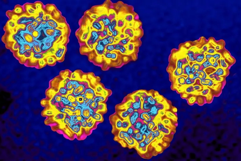 Virus de la hepatitis C (VHC).