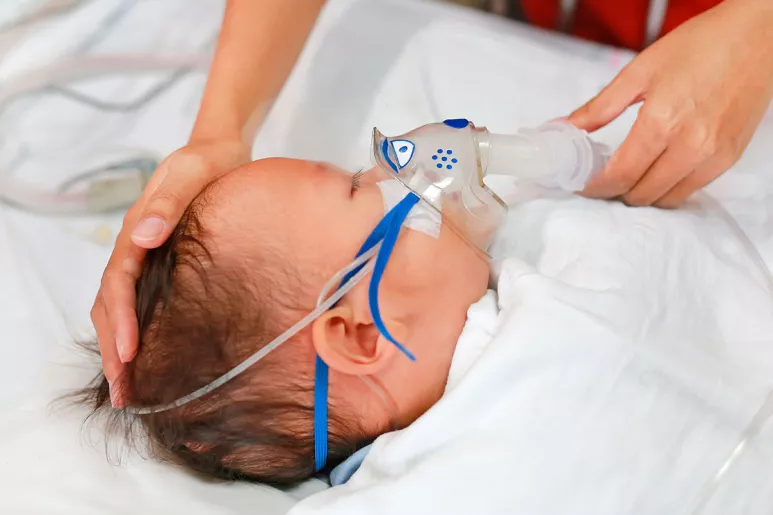 El VRS es la primera causa de bronquiolitis y neumonías en bebés menores de un año.