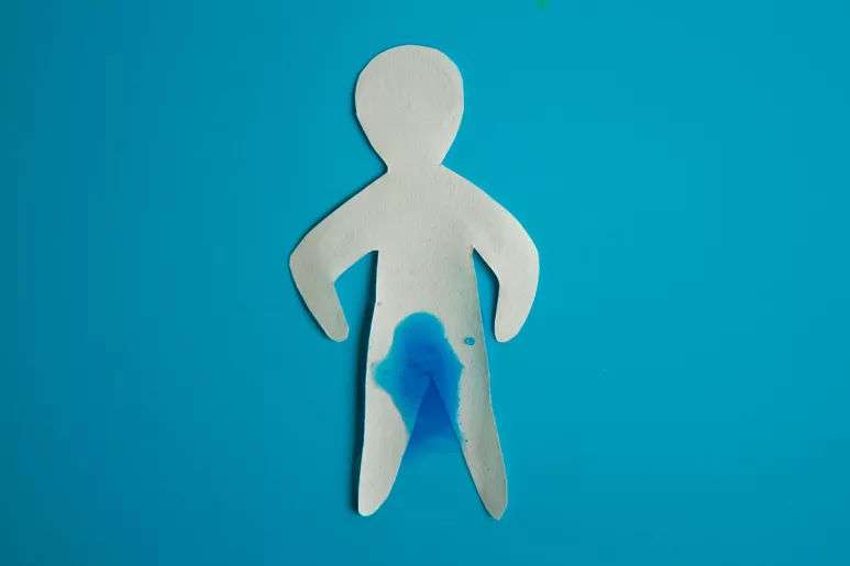 Se calcula que entre el 10-15% de los varones que han sido intervenidos por patología prostática, sobre todo cáncer de próstata, necesitan un tratamiento para la incontinencia urinaria.