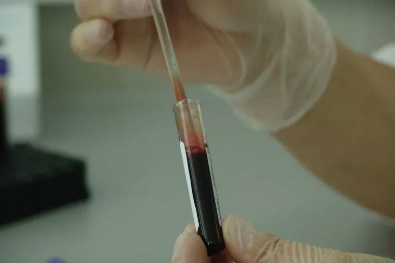 Técnico realizando una prueba de VIH