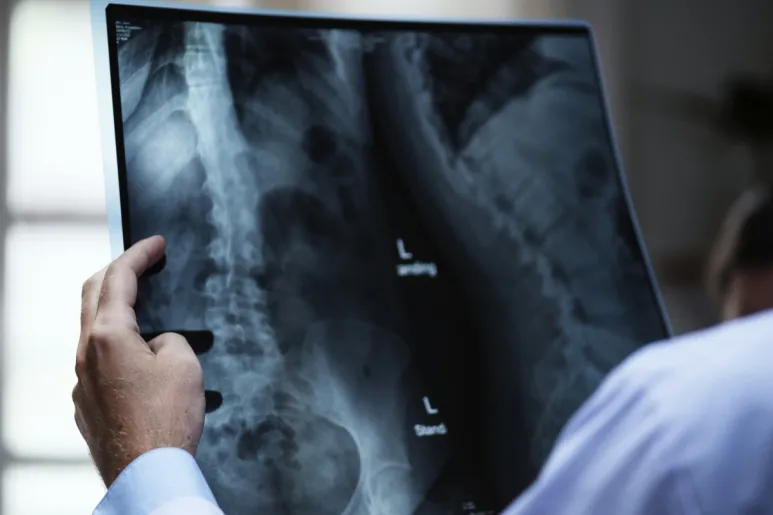 Radiografía de columna vertebral.