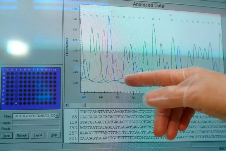 Resultados en el ordenador de un análisis genético (FOTO: Shutterstock). 