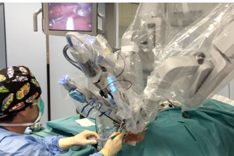 La cirugía robótica ha demostrado reducir secuelas en el cáncer de cabeza y cuello. FOTO: DM. 