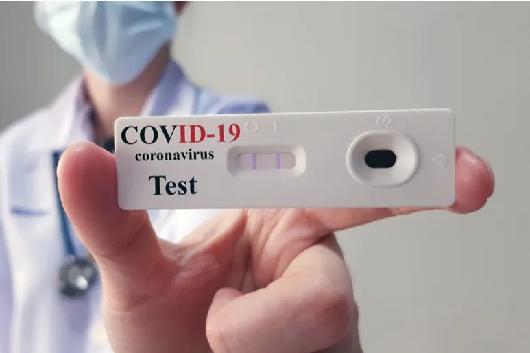 Test de antígenos coronavíricos, para el diagnóstico de la infección por el SARS-CoV-2.