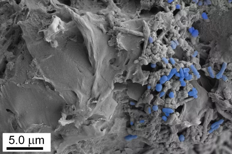 Imagen microscópica de microplásticos colonizados por la microbiota intestinal. Foto: CSIC.
