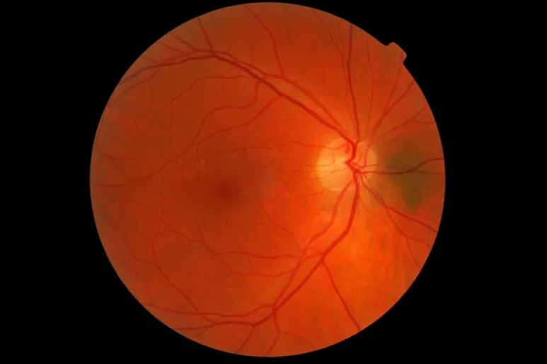 La retina es el órgano encargado de dejar traspasar la imágenes visuales. Foto: DM. 