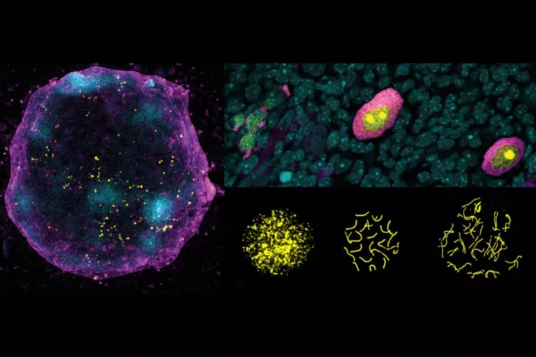 A la izquierda, imagen de un ovario artificial, donde las células germinales femeninas generadas in vitro (magenta) entran en meiosis (células amarillas) para convertirse en ovocitos gracias a las células de apoyo (cian). Arriba a la derecha, ovocitos en diferentes etapas de maduración. Debajo, organización cromosómica durante el proceso de meiosis. Foto: JAQUELINE SEVERINO/CRG