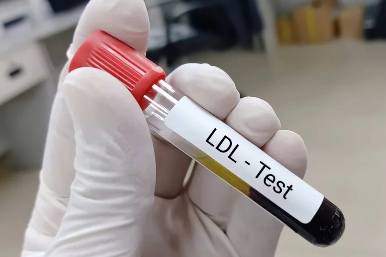 El c-LDL es el objetivo principal en el control del riesgo cardiovascular, pero no el único.