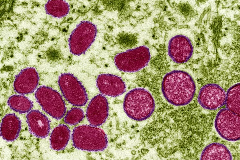 Imagen microscópica del virus de la viruela del mono. Foto: AGESPHOTOSTOCK