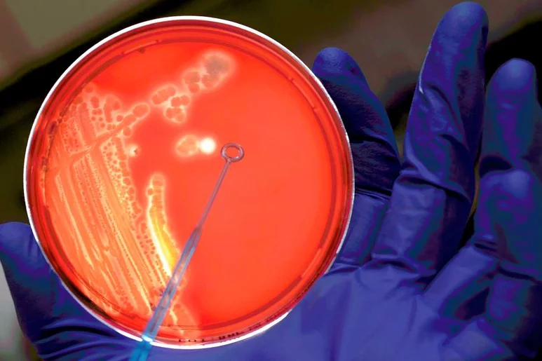 Placa de Petri con 'E. coli'.