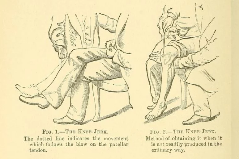 Reflejo rotuliano: al percutir el tendón rotuliano, se contrae el músculo cuádriceps y se produce la extensión de la rodilla.