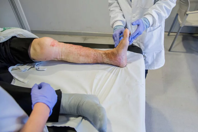 Una enfermera de atención primaria busca el pulso al pie para comprobar la circulación. Foto: ARIADNA CREUS Y ÀNGEL GARCÍA (BANC IMATGES INFERMERES).