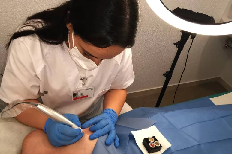 Marián Sellés, enfermera responsable de la consulta de enfermería de práctica avanzada de micropigmentación realizando la técnica a una paciente.
