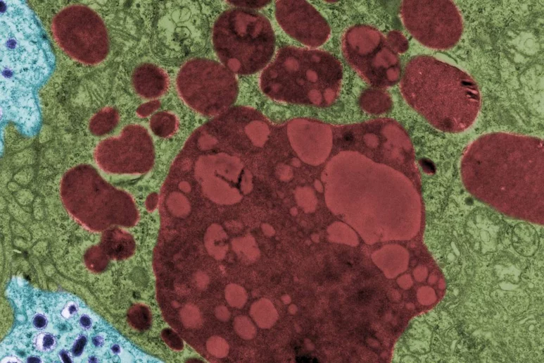 Imagen por microscopio electrónico de lisosomas celulares (en rojo). Foto: SHUTTERSTOCK