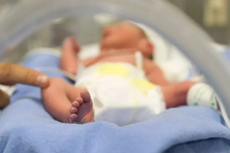 La prueba más sencilla para detectar la fibrosis quística en los recién nacidos es el llamado "test del sudor". Foto: DM.