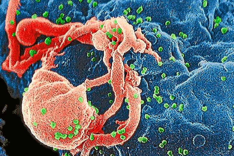 Virus del VIH infecta a un linfocito.