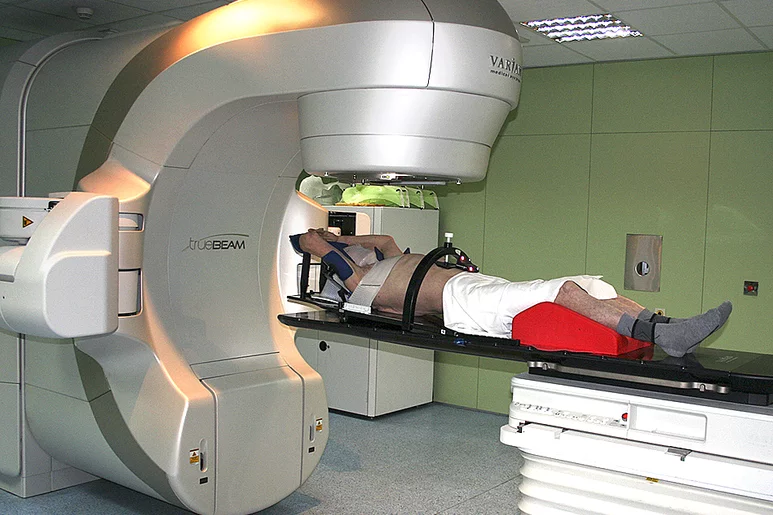Un paciente se somete a la nueva técnica radiológica para el cáncer de pulmón no operable