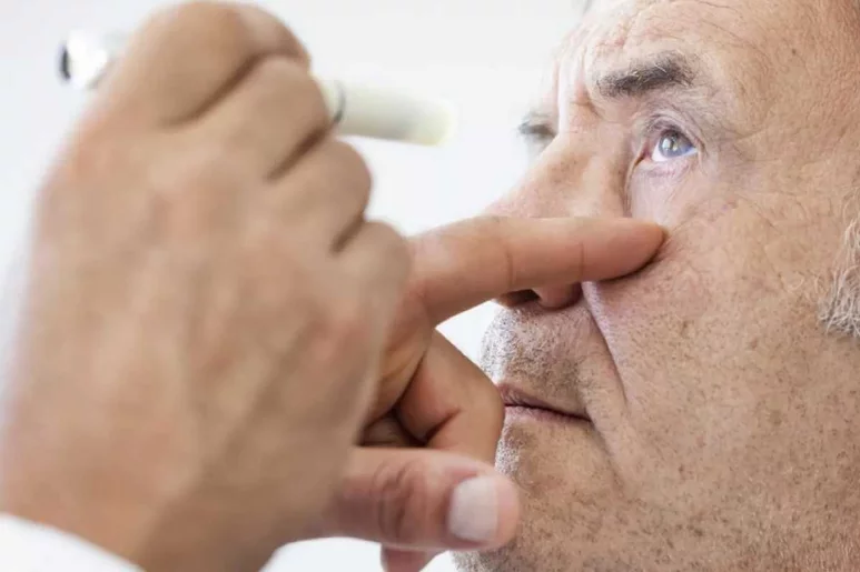  La población con cataratas oculares sube al 71% en la franja de entre 70 y 80 años.