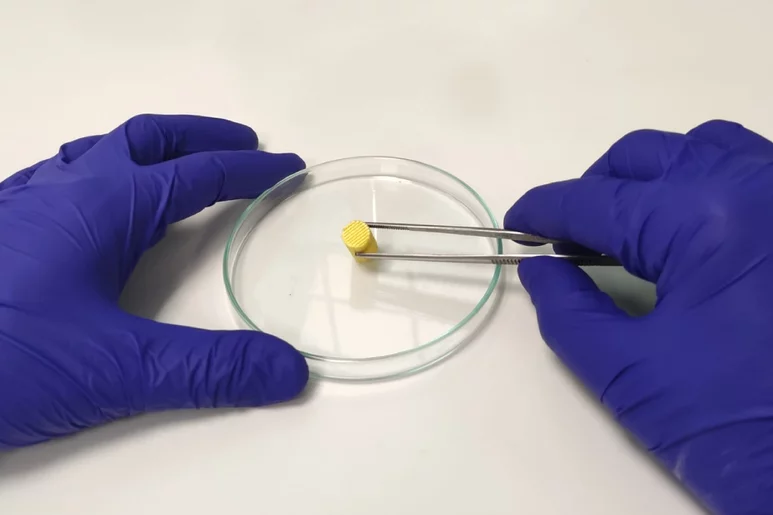 El nuevo material poroso diseñado en la UCV es capaz de regenerar hueso con un efecto antimicrobiano.