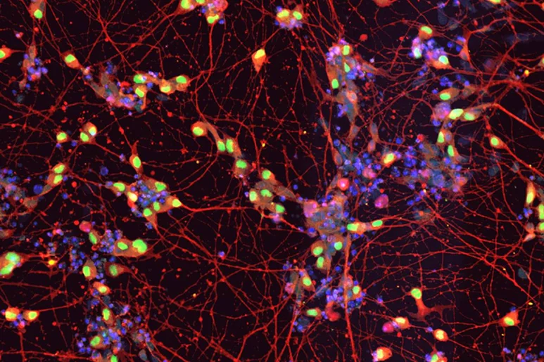 Neuronas motoras derivadas de células madre pluripotentes inducidas de pacientes con ELA. Foto: 'CELL STEM CELL'