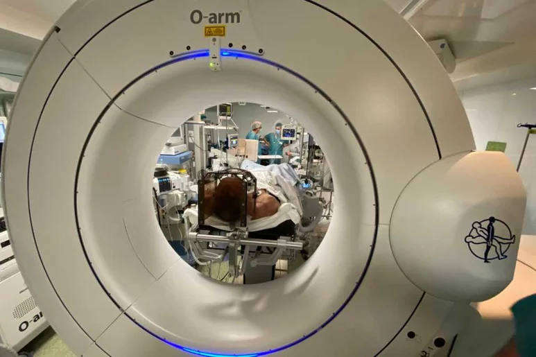 Un paciente es sometido a neurocirugía para implantarle el dispositivo de estimulación cerebral profunda. Foto: HOSPITAL CLÍNIC.