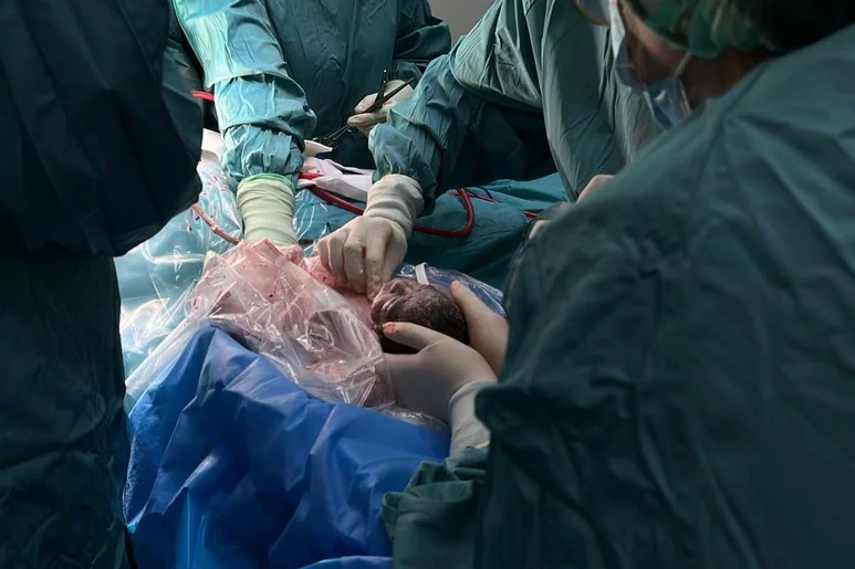 La reanimación del neonato, aún unido por el cordón, se hace muy cerca de la madre. Foto: HOSPITAL DE SANT PAU. 