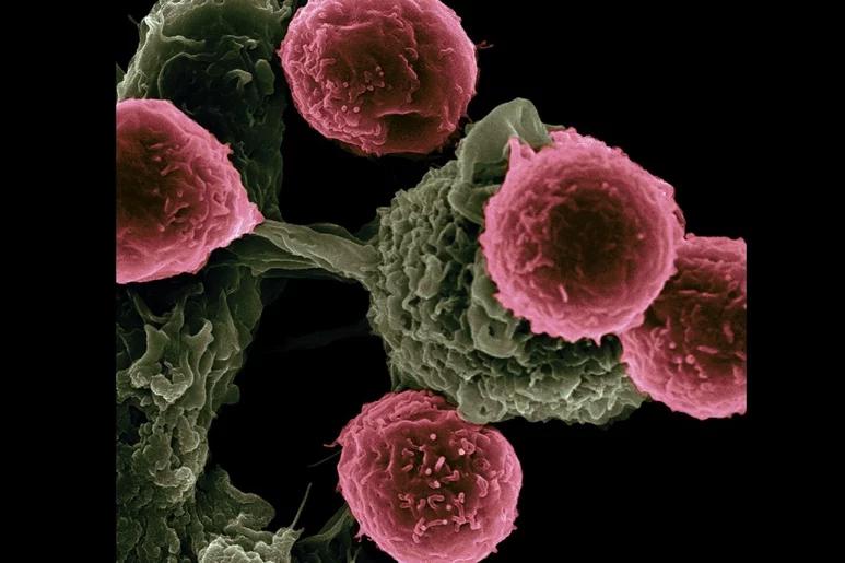 Superficie de una célula cancerosa. Foto: NATIONAL CANCER INSTITUTE.