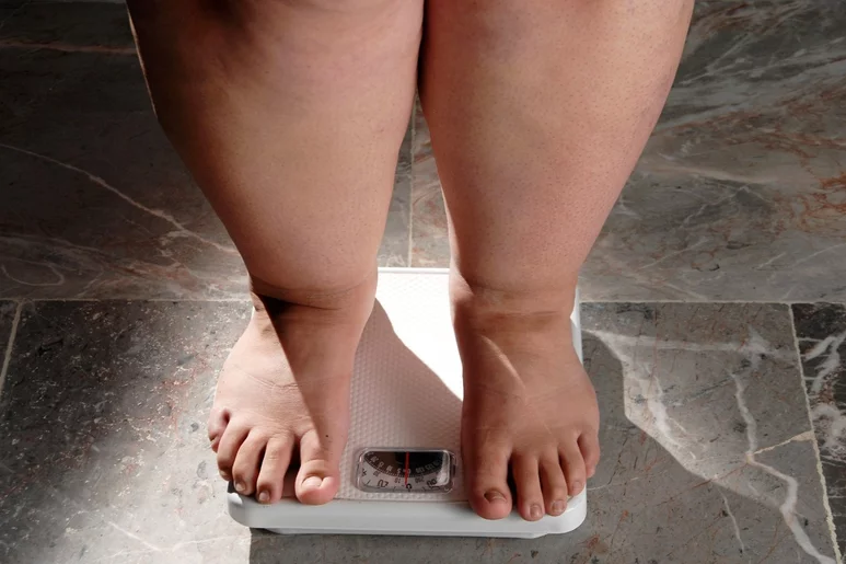 En los últimos 50 años se ha aprendido mucho sobre la obesidad. Foto: SHUTTERSTOCK.