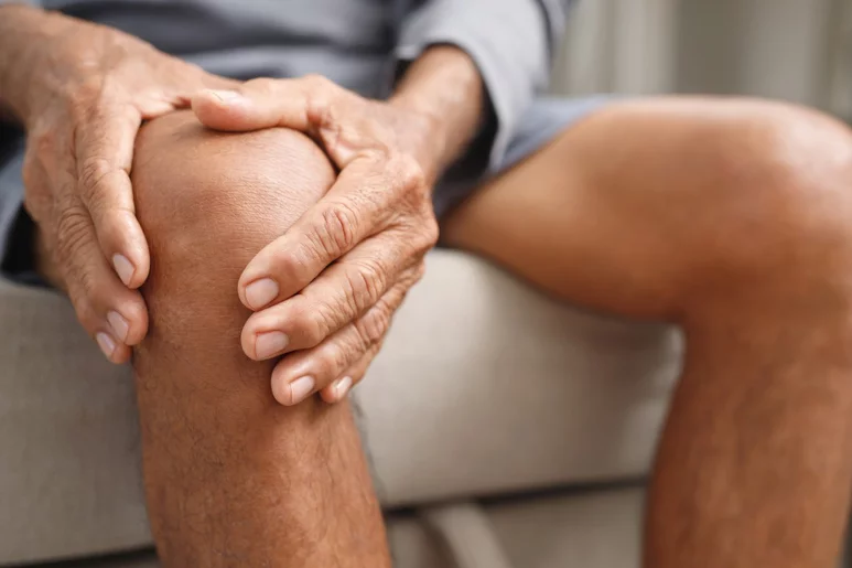 Las rodillas son una de las zonas más afectadas por la osteoartritis. Foto: SHUTTERSTOCK.