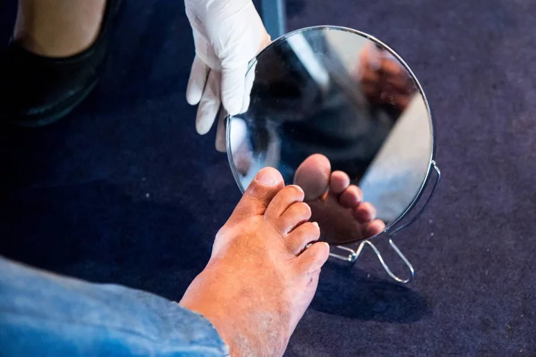 La autoexploración del pie en busca de lesiones es un hábito imprescindible de la persona con diabetes. Foto: SHUTTERSTOCK.