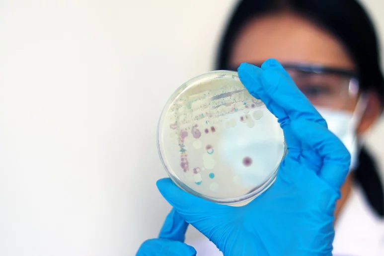 Un sanitario sostiene una placa de Petri de 'Vibrio vulnificus'. Foto: SHUTTERSTOCK.