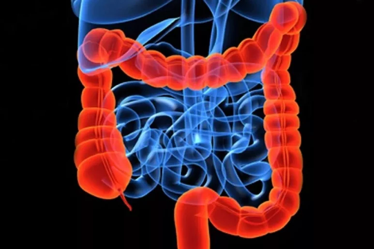 El Crohn, que afecta a personas jóvenes, va en aumento. Foto: DM. 