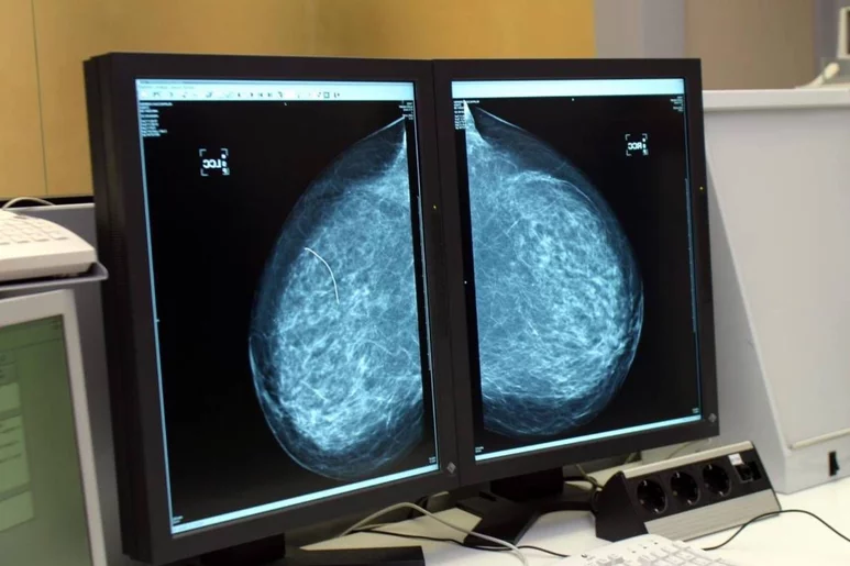 Esta nueva iniciativa acaba de arrancar  con un circuito específico para sospecha de cáncer de mama. 