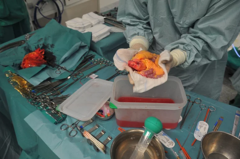 Un cirujano sostiene un corazón que va a ser trasplantado en el Hospital Puerta de Hierro, en Madrid. Foto: DM.