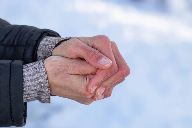 Proteger las manos con guantes y no pasar bruscamente del frío al calor son medidas útiles para prevenir los sabañones. Foto: SHUTTERSTOCK.