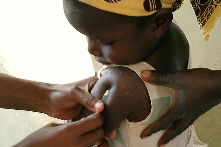 La vacunación antimalárica es fundamental en países del África subsahariana. Foto: DM. 