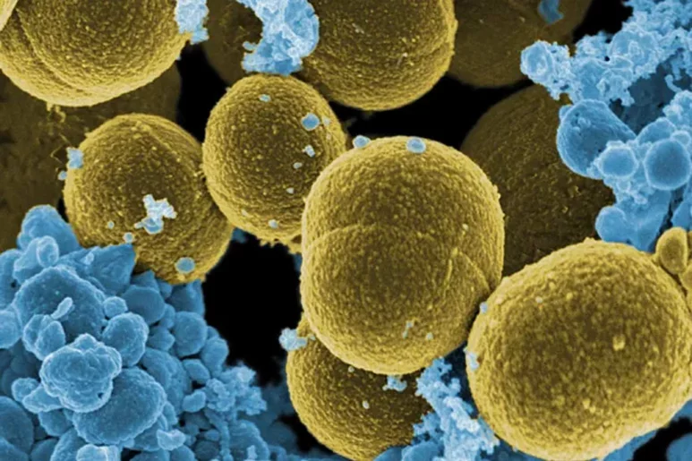 Una cepa de 'Staphylococcus aureus' vista al microscopio.